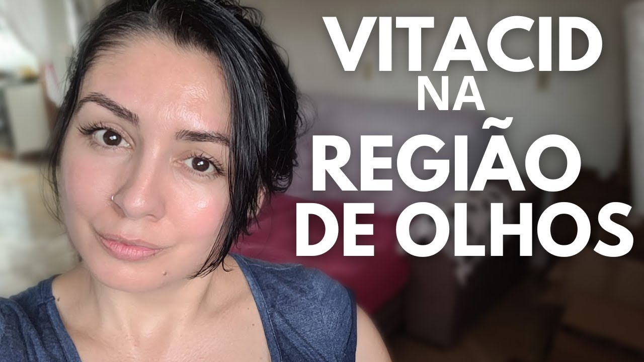 EU USO VITACID 0,05% creme na REGIÃO DE OLHOS E MOSTREI A APLICAÇÃO