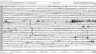 Live Earthquake Monitoring: Digital Seismic Sensor: M7.3 quake near Indonesia