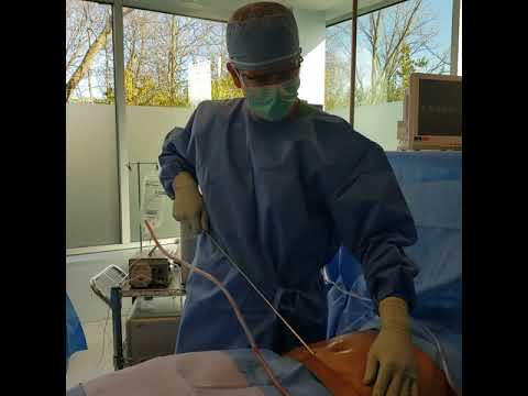 Dr. Dorner gives Botched patient a new look- Part 2