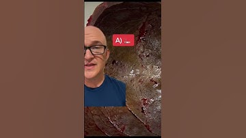 Forensic Friday 4 #forensics #science #health