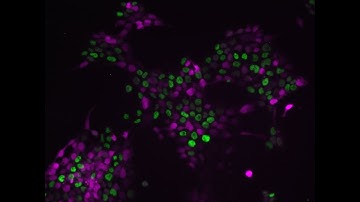 Nuclear Segmentation Tutorial in FIJI/ImageJ using the Multichannel Nuclear Analysis plugin
