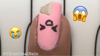😭 BROKEN NAIL REPAIR - EMERGENCY SOS 😨