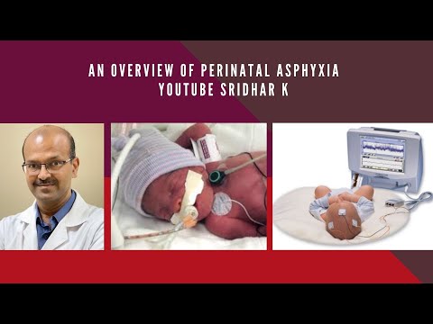 Perinatal asphyxia. An overview of perinatal asphyxia. Therapeutic hypothermia. Dr Sridhar K