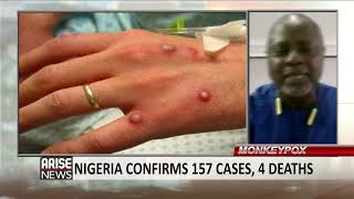 Fg Must Negotiate For Smallpox Vaccines To Protect Against Monkeypox - Prof. S. Omilabu