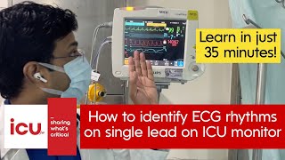 How to identify ECG rhythms on single lead on ICU & ED monitors; learn in 35 minutes!
