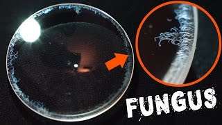 How to Remove Fungus from a Camera Lens FAST & EASY