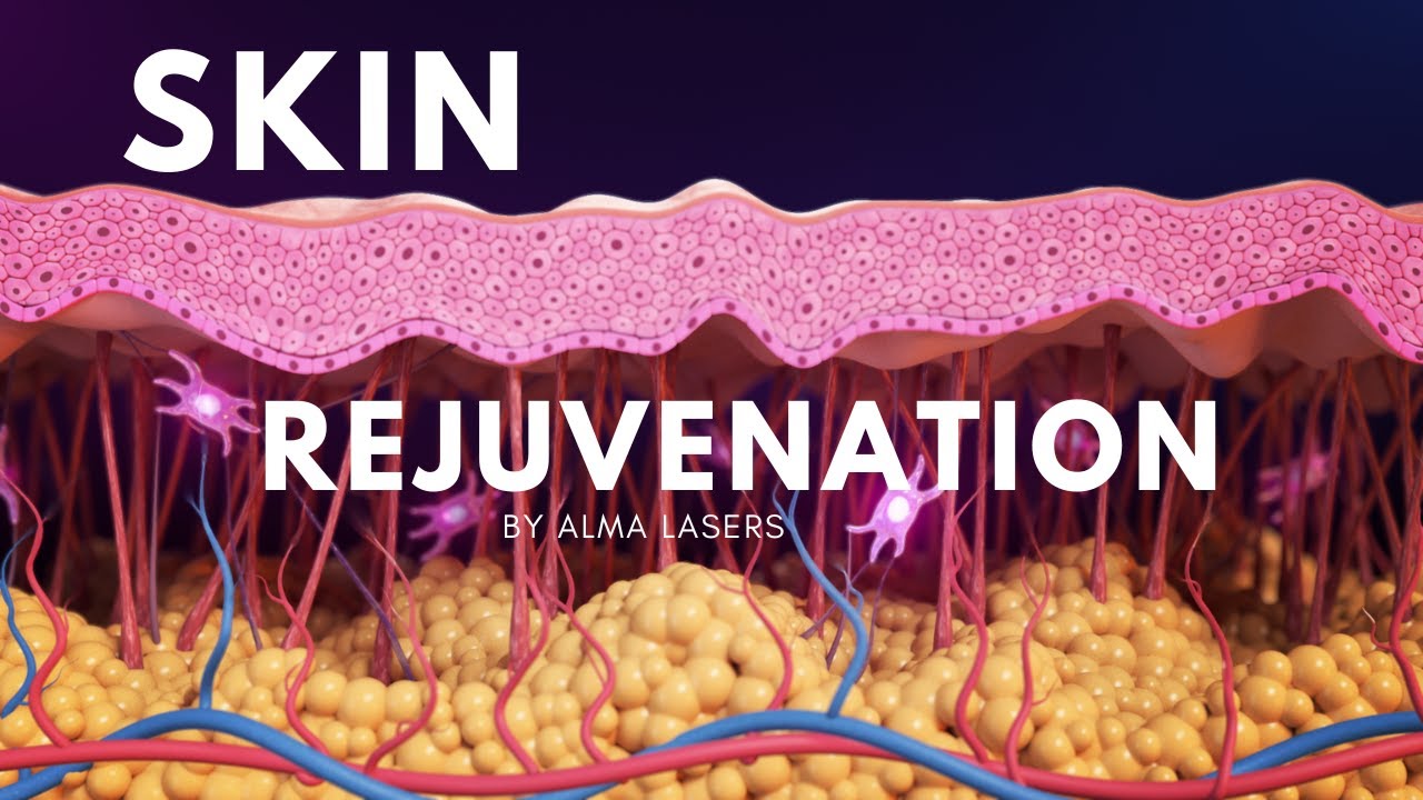 Watch: 3D Animation of Alma Harmony Laser for Skin Rejuvenation