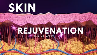 Watch 3d Animation Of Alma Harmony Laser For Skin Rejuvenation
