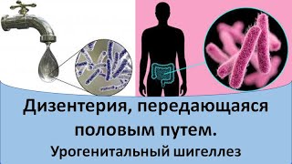 Дизентерия, передающаяся половым путем.  Урогенитальный шигеллез