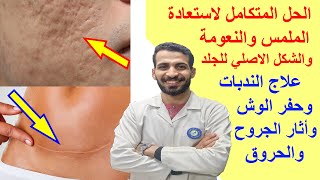 علاج الندبات وأثار الجروح والحروق والعمليات الجراحيةوحفر الوش وحب الشباب بديل عمليات التجميل والليزر