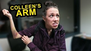 What's Wrong w/ Colleen's Arm?