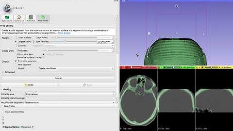 CT scans Skull stripping using 3D Slicer