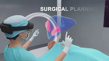 HiPerNav - High Performance Soft-tissue Navigation European Project