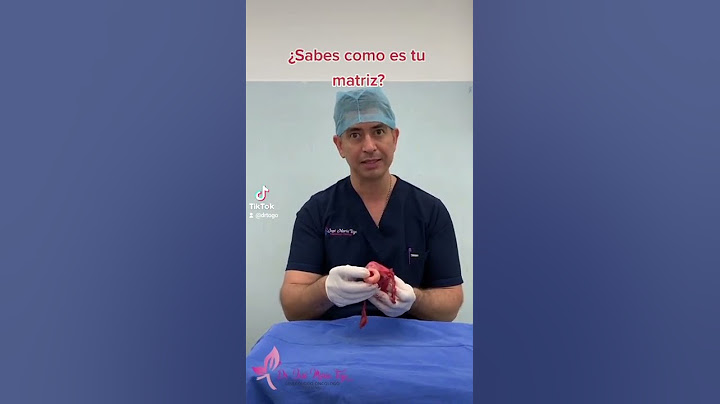 ¿Sabes como es tu matriz?