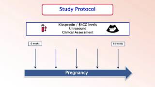 Performance Of Plasma Kisspeptin As A Biomarker For Miscarriage Improves With Gestation...