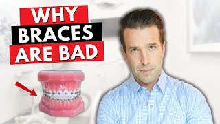 Why Braces are Bad!