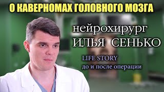 Кавернома головного мозга - оперировать или нет? Нейрохирург Илья Сенько. История пациентки.