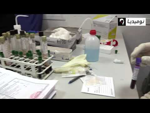 محياوي الحالات الخاضعة لعلاج كلوروكين لم تتعرض لأي مضاعفات