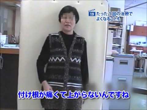 症例19 治りにくい五十肩が一回の治療で治った