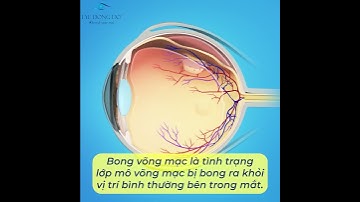 Bong võng mạc - Điều trị ngay để phòng tránh nguy cơ mất thị lực