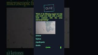 Medical Test Time —Urinalysis &amp; Body Fluids— PART 32
