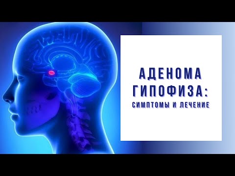 Аденома гипофиза: причины, симптомы, операция и лечение