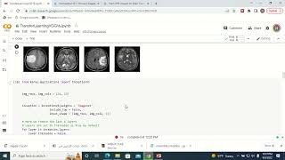 Python Code for Brain MRI Images classification using InceptionV3 Model-Demo