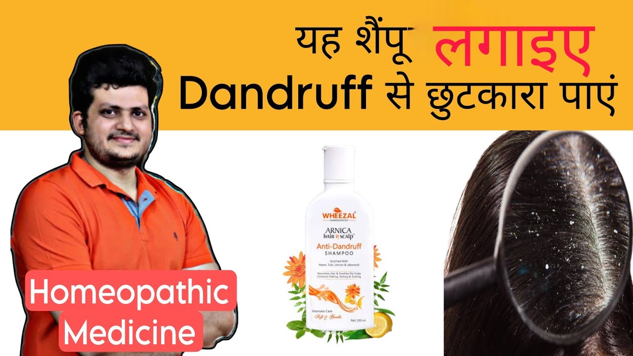 यह Homeopathic Shampoo लगाइए Dandruff से छुटकारा पाया Arnica Anti