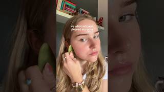 Famous what actually clears #ACNE ‼️ Net Worth