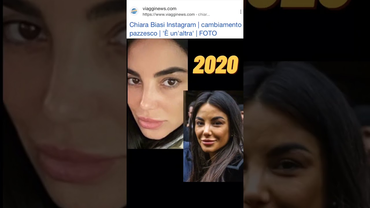 CHIARA BIASI: come si è rovinata con la chirurgia | TUTTE LE TRASFORMAZIONI