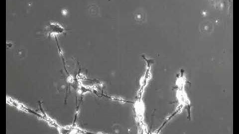 Brain cells in a culture dish trying to form connections with each other...