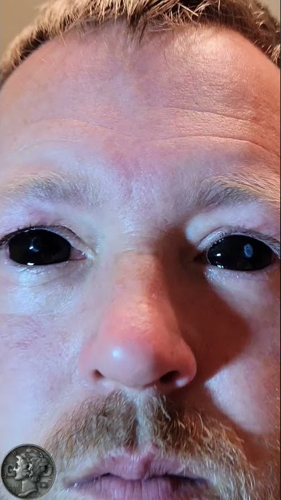 My Eyes Turned Black #shorts