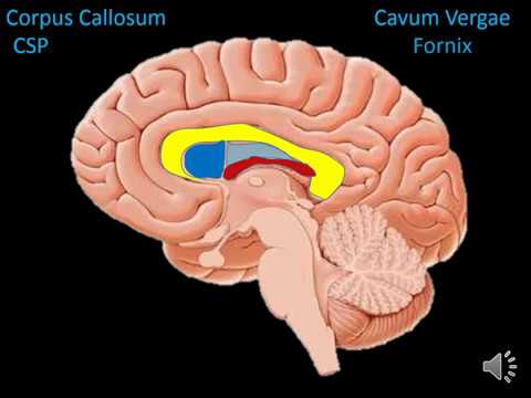 Видео: Корпус Callosum, Agenesis: причины, симптомы и лечение