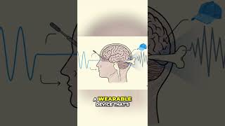 Brain Interface Race: Invasive vs. Non-Invasive for Billions! #shorts