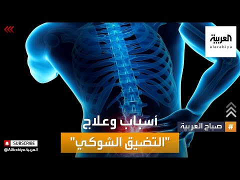 فيديو: ماذا تعني النقطة الشوكية؟