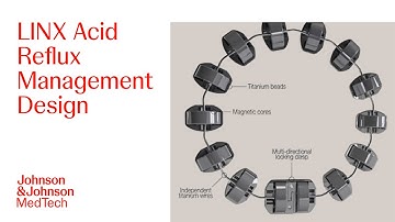 LINX Acid Reflux Management System Design | J&J MedTech