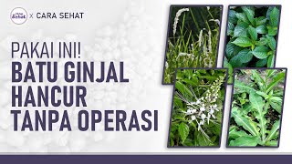 Cara Alami Meluruhkan Batu Ginjal, Tanpa Operasi! | Hidup Sehat tvOne