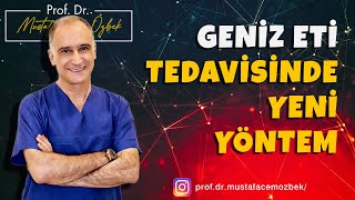 Geniz Eti Tedavisinde Yeni Yöntem