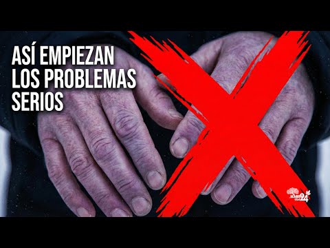 ¿MALA CIRCULACIÓN? Así empiezan los problemas serios