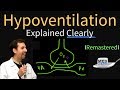 Hypoventilation and Hypoxemia Explained Clearly - Remastered