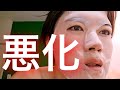 【酒さ 再発】肌荒れ歴21年の日常 (お久ぶりです)