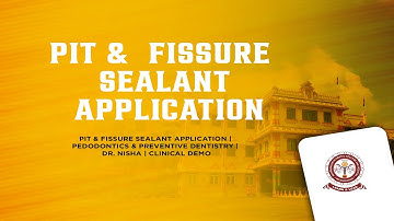 Pit & Fissure Sealant Application | Pedodontics & Preventive Dentistry | Dr. Nisha | Clinical Demo
