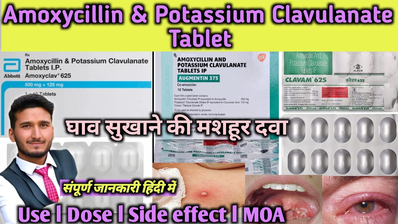 Amoxicillin And Potassium Clavulanate Tablets Ip L Amoxyclav Tablet Use amoxicillin-and-potassium-clavulanate-tablets-ip-l-amoxyclav-tablet-use