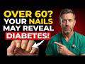 Is Your Fatigue More Than Just Aging? Check Your Nails!