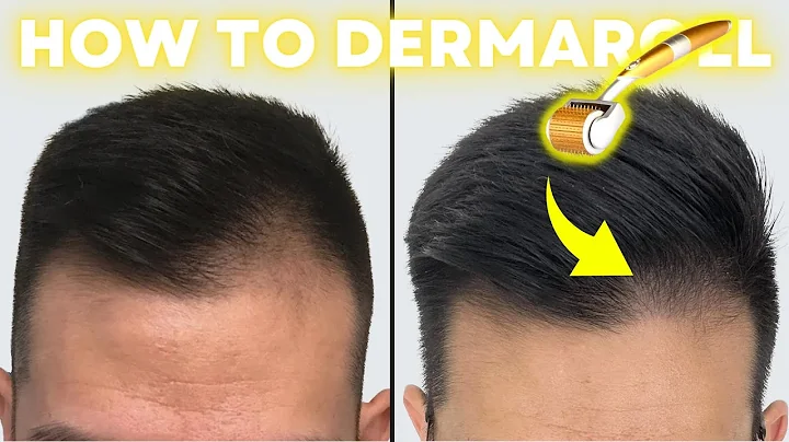 How to Derma Roll for Quickest Hair Results (Step-by-Step Guide) - DayDayNews