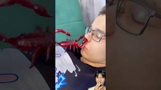 Digigit Kalajengking⁉️ #shorts #funny #animals