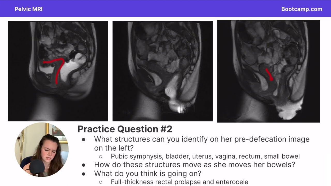 MRI Pelvic Anatomy for Med School | Radiology | Med School Bootcamp