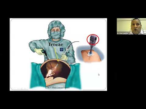 Видео: Cirugía de Esterilización (Кастрасион) и Хембра