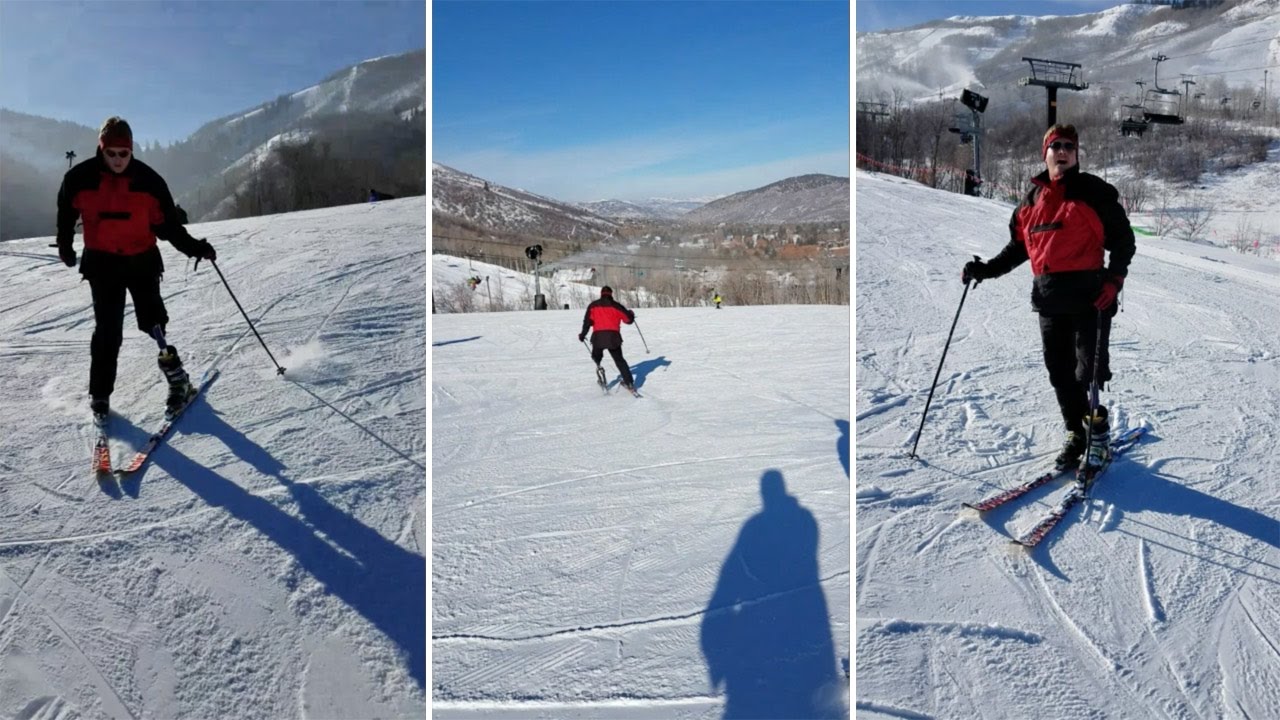 Inspirational Amputee Begins To Ski Again
