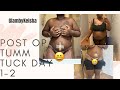 Emotional Post Op Tummy Tuck Vlog | Day 1-2